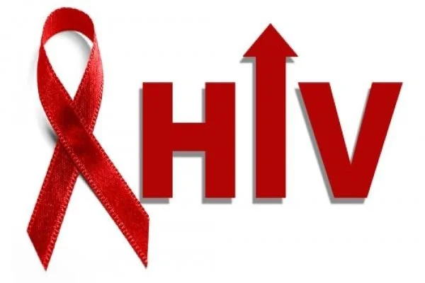 Ilustrasi HIV (Dok : Int).